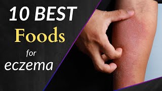 These 10 Foods will Help You Get Rid of Eczema [upl. by Chard]