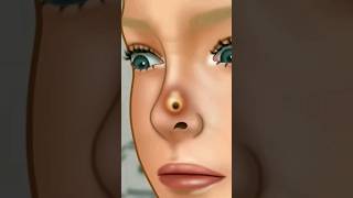 shorts ASMR Girl nose treatment animation ytviral makeup skincare asmrskincare [upl. by Odrude]