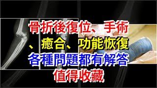 骨折後復位、手術、癒合、功能恢復，各種問題都有解答，值得收藏 [upl. by Audrie]