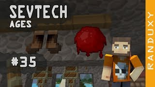 SevTech Ages Minecraft  Ep35  Coagulated Blood and Boots of Escaping “Wild Dog Pelt Boots” [upl. by Linda374]