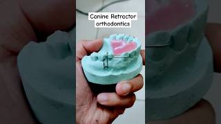 Reverse loop canine retractor ortho appliance [upl. by Norraa817]