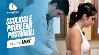 Scoliosi e problemi posturali il Caso di Mary [upl. by Vincelette209]