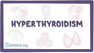 Hyperthyroidism  an Osmosis Preview [upl. by Nolyaj]