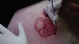 Scarification [upl. by Imre]