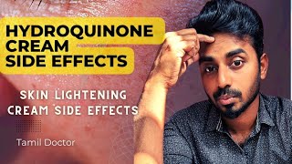 Hydroquinone Side effects  Skin lightening cream side effects drthamizhinian skinlightening [upl. by Aiekam]