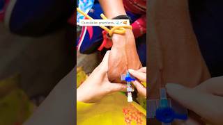 Iv cannulation procedure 🧑‍⚕️😷 shorts cannula trending youtubeshorts mbbs doctor love song [upl. by Adnilre]