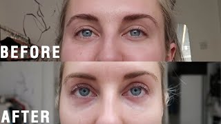 XLASH EYELASH SERUM REVIEW amp RESULTS  STYLE LOBSTER AD [upl. by Lesab420]