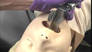 EMS Skills  Using Laryngoscope and Magill Forceps [upl. by Aicila646]