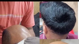 Hair Patch l Hair Work l hair youtubeshorts viralvideo unisexbeautyandhairsaloon [upl. by Nifares]