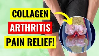 The Truth About Collagen for Arthritis Pain [upl. by Oreves]