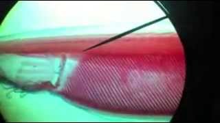 Anatomy of Amphioxus تشريح السهيم  YouTube [upl. by Trebleht45]