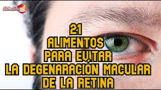 21 Alimentos para evitar la degenaración macular de la retina [upl. by Oibesue]