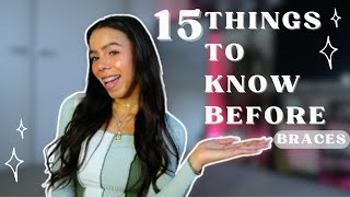 15 Things I Wish I Knew Before Getting Braces [upl. by Pallua990]