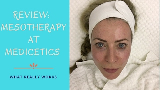 Review of Mesotherapy treatment at Medicetics clinic [upl. by Droflim]