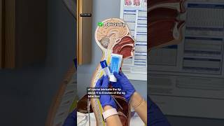 NG tube Catheter insertion NEET2025👇👇 mbbsmotivation studymotivation viralvideo [upl. by Aldos]