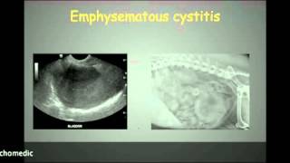 Abdominal ultrasound part 8 [upl. by Ahsinna755]