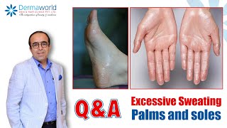 QnA with Dr Rohit Batra  Excessive Sweating Palms and soles  Hyperhidrosis Treatment  In Hindi [upl. by Wallache]