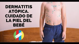 Dermatitis Atópica Cuidado de la piel del bebé [upl. by Spencer]