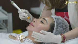 Femmy Permatasari Laser Glowing Skin With team Insert Trans TV [upl. by Manville]