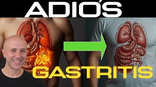 CURA tu GASTRITIS ¡Con estos pasos [upl. by Ellehcram392]