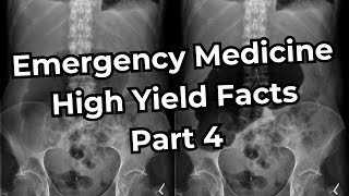 Emergency Medicine Board Exam High Yield Facts Part 4 [upl. by Ennasus]