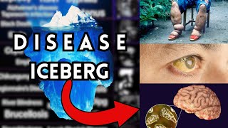 The Disease Iceberg Explained [upl. by Terces675]