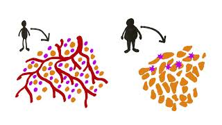 Obesity type 2 diabetes and the metabolic syndrome [upl. by Eahsan]