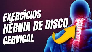 Ideias de EXERCÍCIOS para HÉRNIA DE DISCO CERVICAL [upl. by Oahc]