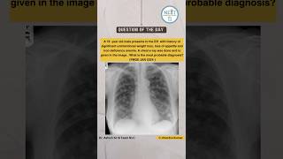 Options are  A Bronchogenic carcinoma B Asthma C Metastasis D Pneumoconiosis [upl. by Nevar917]