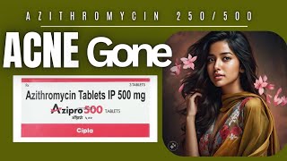 Azithromycin 500 For Pimples  ACNE tablets  Clear Medicine [upl. by Enatan]