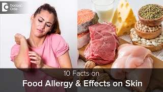 Food Allergy amp how it affects SKIN  Causes Symptoms amp TreatmentDrRajdeep Mysore Doctors Circle [upl. by Adnirak]