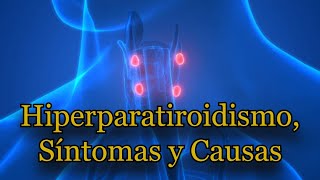 Hiperparatiroidismo Síntomas y Causas [upl. by Netsrijk]