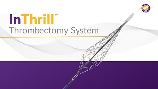 InThrill Thrombectomy System [upl. by Aviva]