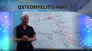 Osteomyelitis  Causes amp Symptoms  Bone Infection🩺 [upl. by Ative]