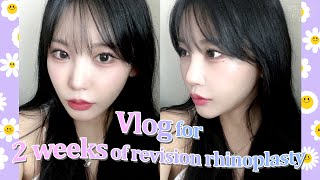 nose job VLOG Revision rhinoplasty  fat grafting at BYUL Korea🥰💜 [upl. by Fevre]