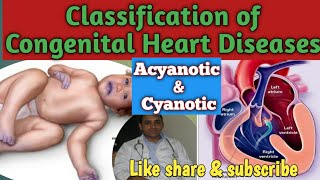 Classification of CHDs  Acyanotic amp Cyanotic Heart Diseases  Physiological classification of CHD [upl. by Claribel351]