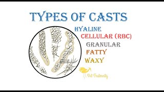 Types Of casts  Hayline Cellular RBC Granular Fatty Waxy  Part 2  Urinalysis  bcse navle [upl. by Chally]