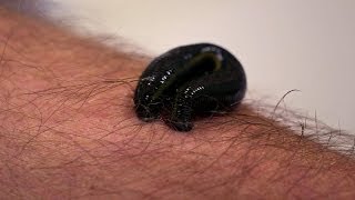 Michael Mosley is bitten by a leech  Infested Living with Parasites  BBC Four [upl. by Alfonzo]