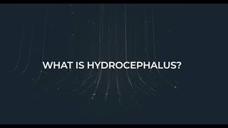 About Hydrocephalus [upl. by Regan771]