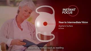 INSTANT FOCUS™  the Ultimate EDOF IOL Technology [upl. by Sauncho]