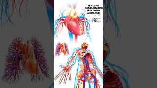 Tricuspid Regurgitation Treatment Animation medical animation 3d short [upl. by Sidnal267]