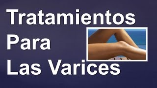 TRATAMIENTOS PARA LAS VARICES  Tratamiento de las varices naturalmente [upl. by Pepito]