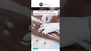 What are the BENEFITS of HIJAMA [upl. by Netaf]