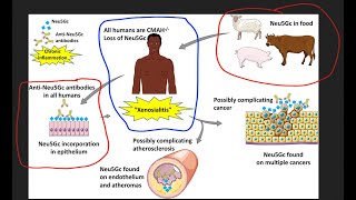 Do you have XenoSialitis Autoimmune inflammation disease rerun [upl. by Peterus129]