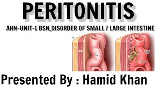 Peritonitis  causes manifestation pathophysiology and nursing interventionAhn unit 1 git disorder [upl. by Stephanie639]