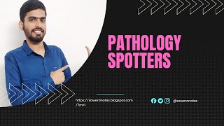 Spotters of pathology practical exam  Pathology spotters [upl. by Sibyls]