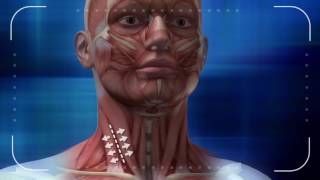 3D Animation of ACDF spine procedure by Media 3D [upl. by Nich450]