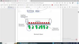 Nephritic Syndrome [upl. by Irmgard]