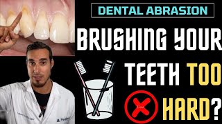 DENTAL WEAR  BRUSHING your TEETH TOO HARD can damage your teeth and GUMS [upl. by Barabas]