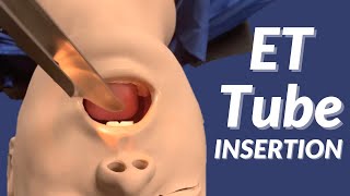 How to Insert an Endotracheal Tube ET Tube [upl. by Enamrahs81]